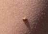 calviaquattuordecimguttatacoccinelle14macules_small.jpg